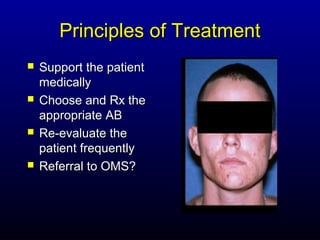 Principles of Treatment
   Support the patient
    medically
   Choose and Rx the
    appropriate AB
   Re-evaluate the
    patient frequently
   Referral to OMS?
 