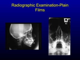 Radiographic Examination-Plain
            Films
 