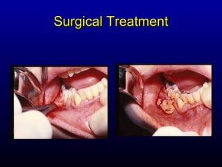Surgical Treatment
 