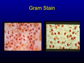 Gram Stain
 