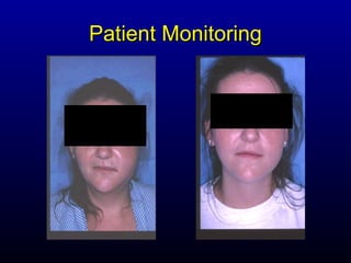 Patient Monitoring
 