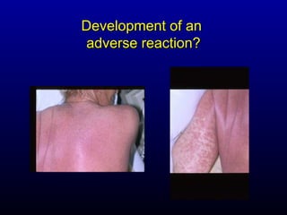 Development of an
adverse reaction?
 
