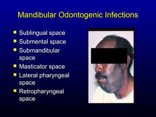 Mandibular Odontogenic Infections

   Sublingual space
   Submental space
   Submandibular
    space
   Masticator space
   Lateral pharyngeal
    space
   Retropharyngeal
    space
 