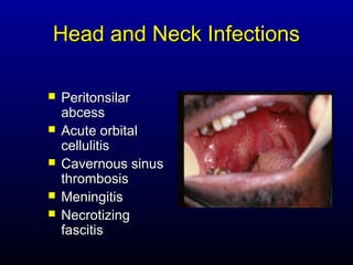 Head and Neck Infections

   Peritonsilar
    abcess
   Acute orbital
    cellulitis
   Cavernous sinus
    thrombosis
   Meningitis
   Necrotizing
    fascitis
 