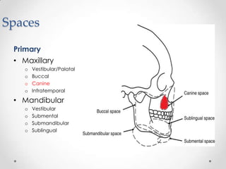 Spaces
Primary
• Maxillary
o Vestibular/Palatal
o Buccal
o Canine
o Infratemporal
• Mandibular
o Vestibular
o Submental
o Submandibular
o Sublingual
 
