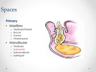Spaces
Primary
• Maxillary
o Vestibular/Palatal
o Buccal
o Canine
o Infratemporal
• Mandibular
o Vestibular
o Submental
o Submandibular
o Sublingual
 