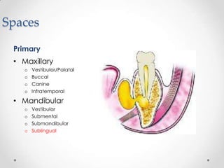 Spaces
Primary
• Maxillary
o Vestibular/Palatal
o Buccal
o Canine
o Infratemporal
• Mandibular
o Vestibular
o Submental
o Submandibular
o Sublingual
 
