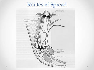 Routes of Spread
 