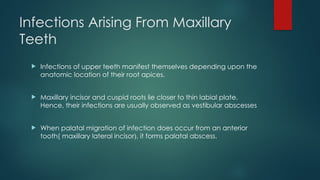 Palatal Infection Odontogenic Infections: Etiology, Pathogenesis, and Management | PPTX