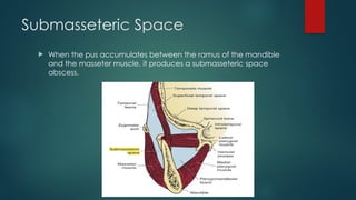 Submasseter Space Odontogenic Infections: Etiology, Pathogenesis, and Management | PPTX