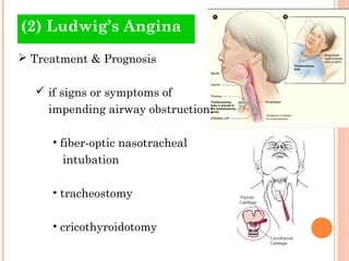 (2) Ludwig’s Angina
 Treatment & Prognosis

   if signs or symptoms of
     impending airway obstruction:

     • fiber-optic nasotracheal
       intubation

     • tracheostomy

     • cricothyroidotomy
 