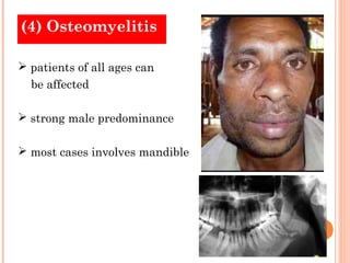 (4) Osteomyelitis

 patients of all ages can
  be affected

 strong male predominance

 most cases involves mandible
 