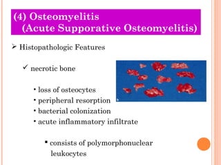 (4) Osteomyelitis
  (Acute Supporative Osteomyelitis)
 Histopathologic Features

    necrotic bone

      • loss of osteocytes
      • peripheral resorption
      • bacterial colonization
      • acute inflammatory infiltrate

          consists of polymorphonuclear
           leukocytes
 