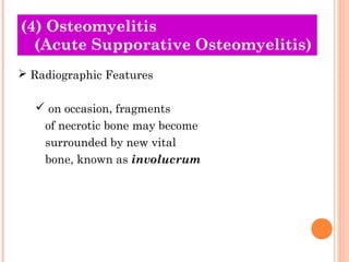 (4) Osteomyelitis
  (Acute Supporative Osteomyelitis)
 Radiographic Features

   on occasion, fragments
    of necrotic bone may become
    surrounded by new vital
    bone, known as involucrum
 