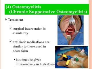 (4) Osteomyelitis
  (Chronic Supporative Osteomyelitis)
 Treatment

   surgical intervention is
    mandatory

   antibiotic medications are
    similar to those used in
    acute form

     • but must be given
      intravenously in high doses
 