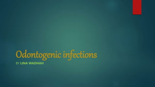 Odontogenic infections
BY LINA WADHAH
 