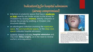 Odontogenic infections (fascial spaces).pptx