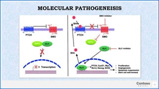 Contoso
S u i t e s
11
MOLECULAR PATHOGENEISIS
 