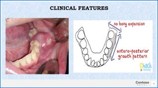 Contoso
S u i t e s
16
CLINICAL FEATURES
 
