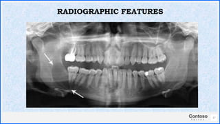 Contoso
S u i t e s
17
RADIOGRAPHIC FEATURES
 