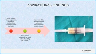 Contoso
S u i t e s
ASPIRATIONAL FINDINGS
Dirty , creamy
viscid suspension,
resembling
parakeraitned
squamous cells in
the fluid.
Total protein
content in the fluid
is less than 4.8 g
per 100mL.
Major part of the
protein content is
Albumin is
basically a less
soluble protein.
 
