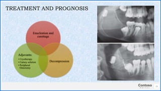 Contoso
S u i t e s
Enucleation and
curettage
Decompression
Adjuvants:
• Cryotherapy
• Carnoy solution
• Peripheral
Ostectomy
23
TREATMENT AND PROGNOSIS
 