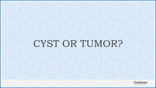 Contoso
S u i t e s
25
CYST OR TUMOR?
 