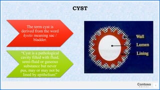 Contoso
S u i t e s
The term cyst is
derived from the word
kystis meaning sac /
bladder.
“Cyst is a pathological
cavity filled with fluid,
semi-fluid or gaseous
substance but never
pus, may or may not be
lined by epithelium”
3
CYST
 
