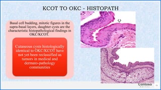 Contoso
S u i t e s
Basal cell budding, mitotic figures in the
supra-basal layers, daughter cysts are the
characteristic histopathological findings in
OKC/KCOT.
Cutaneous cysts histologically
identical to OKC/KCOT have
not yet been reclassified as
tumors in medical and
dermato-pathology
communities
35
KCOT TO OKC - HISTOPATH
 