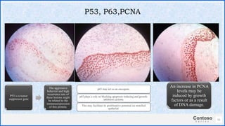 Contoso
S u i t e s
51
P53, P63,PCNA
P53 is a tumor
suppressor gene
The aggressive
behavior and high
recurrence rate of
these lesions might
be related to the
immunoexpression
of this protein.
p63 may act as an oncogene.
p63 plays a role on blocking apoptosis-inducing and growth-
inhibitory actions.
This may facilitate its proliferative potential on stratified
epithelial
An increase in PCNA
levels may be
induced by growth
factors or as a result
of DNA damage.
 