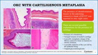 Contoso
S u i t e s
60
OKC WITH CARTILIGENOUS METAPLASIA
ESKENDRI J, FELICIANO R, REICH R, FREEDMAN P. CARTILAGENOUS METAPLASIA IN ODONTOGENIC KERATOCYST (OKC): CASE SERIES AND IMMUNOHISTOCHEMICAL ANALYSIS.
Oral surgery, oral medicine, oral pathology and oral radiology. 2017 Sep 1;124(3):e203.
The presence of chondromatous
tissues in the adjoining
connective tissue of KCOT was
reported in only eight cases.
There are several possible
explanations for the presence of
cartilage
• Presence of a chondroma;
• Vestigial remains of meckel’s cartilage
• A possible metaplastic change of the
fibrous connective tissue in response to
chronic irritation;
• A possible induction of the cyst wall by
the epithelial lining;
• Trapped glycosaminoglycans.
 
