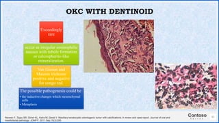 Contoso
S u i t e s
61
OKC WITH DENTINOID
Exceedingly
rare
occur as irregular eosinophilic
masses with tubule formation
or calcospherite-like
mineralization.
Van Gieson and
Masson trichome
positive and negative
for congo red.
The possible pathogenesis could be
• the inductive changes which mesenchymal
cells
• Metaplasia
Naveen F, Tippu SR, Girish KL, Kalra M, Desai V. Maxillary keratocystic odontogenic tumor with calcifications: A review and case report. Journal of oral and
maxillofacial pathology: JOMFP. 2011 Sep;15(3):295.
 
