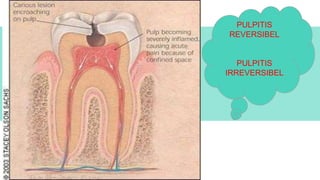 ODONTOGENIC PAIN DRG.NURLAELA TAHIR (1).pptx