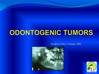 Frederick Mars Untalan, MD
 