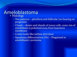 Ameloblastoma Histology
 Two patterns – plexiform and follicular (no bearing on
prognosis)
 Classic – sheets and islands of tumor cells, outer rim of
ameloblasts is polarized away from basement
membrane
 Center looks like stellate reticulum
 Squamous differentiation (1%) – Diagnosed as
ameloblastic carcinoma
 