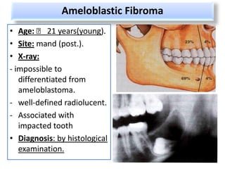 Ameloblastic Fibroma
• Age: ˂ 21 years(young).
• Site: mand (post.).
• X-ray:
- impossible to
   differentiated from
   ameloblastoma.
- well-defined radiolucent.
- Associated with
   impacted tooth
• Diagnosis: by histological
   examination.
 