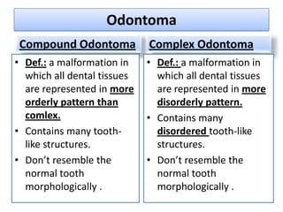 Odontoma
 Compound Odontoma           Complex Odontoma
• Def.: a malformation in    • Def.: a malformation in
  which all dental tissues     which all dental tissues
  are represented in more      are represented in more
  orderly pattern than         disorderly pattern.
  comlex.                    • Contains many
• Contains many tooth-         disordered tooth-like
  like structures.             structures.
• Don’t resemble the         • Don’t resemble the
  normal tooth                 normal tooth
  morphologically .            morphologically .
 