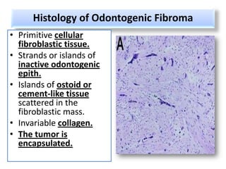 Histology of Odontogenic Fibroma
• Primitive cellular
  fibroblastic tissue.
• Strands or islands of
  inactive odontogenic
  epith.
• Islands of ostoid or
  cement-like tissue
  scattered in the
  fibroblastic mass.
• Invariable collagen.
• The tumor is
  encapsulated.
 