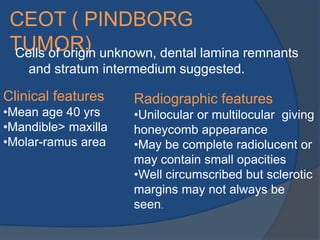 Odontogenic tumors | PPTX