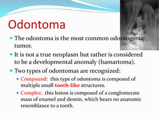 Odontoma
 The odontoma is the most common odontogenic
tumor.
 It is not a true neoplasm but rather is considered
to be a developmental anomaly (hamartoma).

 Two types of odontomas are recognized:
 Compound: this type of odontoma is composed of

multiple small tooth-like structures.
 Complex: this lesion is composed of a conglomerate
mass of enamel and dentin, which bears no anatomic
resemblance to a tooth.

 