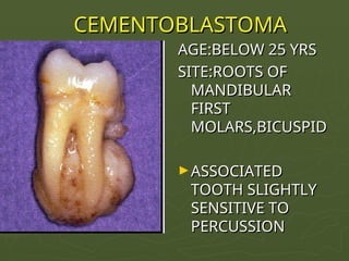 ODONTOGENIC TUMORS OF ORAL CAVITY.pptxxx | PPT