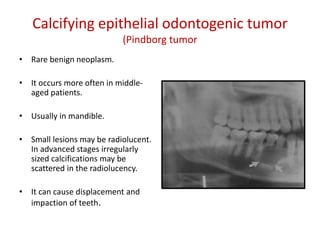 Calcifying epithelial odontogenic tumor
                           (Pindborg tumor
• Rare benign neoplasm.

• It occurs more often in middle-
  aged patients.

• Usually in mandible.

• Small lesions may be radiolucent.
  In advanced stages irregularly
  sized calcifications may be
  scattered in the radiolucency.

• It can cause displacement and
  impaction of teeth.
 