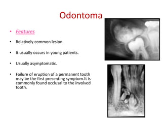Odontoma
• Features
• Relatively common lesion.

• It usually occurs in young patients.

• Usually asymptomatic.

• Failure of eruption of a permanent tooth
  may be the first presenting symptom.It is
  commonly found occlusal to the involved
  tooth.
 
