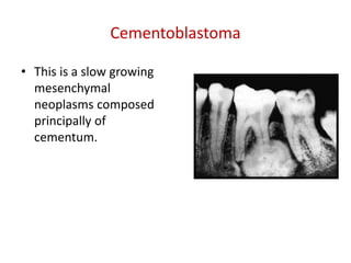 Cementoblastoma

• This is a slow growing
  mesenchymal
  neoplasms composed
  principally of
  cementum.
 