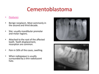 Cementoblastoma
• Features

•   Benign neoplasm. Most commonly in
    the second and third decade.

•   Site: usually mandibular premolar
    and molar regions.

•   Attached to the root of the affected
    tooth. Tooth displacement,
    resorption are common.

•   Pain in 50% of the cases, swelling.

•   When radiopaque is usually
    surrounded by a thin radiolucent
    halo.
 