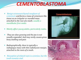 Odontogenic tumours management ih | PPTX