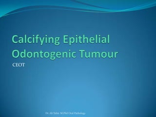 Odontogenic tumours part 2 | PPTX