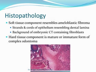Histopathology
 Soft tissue component resembles ameloblastic fibroma
    Strands & cords of epithelium resembling dental lamina
    Background of embryonic CT containing fibroblasts
 Hard tissue component is mature or immature form of
  complex odontoma




               Dr. Ali Tahir. M.Phil Oral Pathology
 