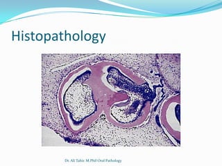 Histopathology




       Dr. Ali Tahir. M.Phil Oral Pathology
 