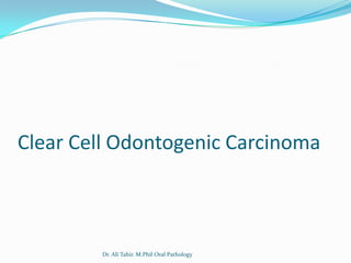 Clear Cell Odontogenic Carcinoma



        Dr. Ali Tahir. M.Phil Oral Pathology
 